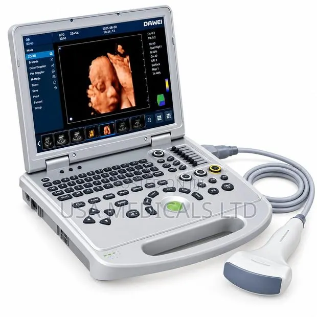 Ultrasound Scan Trolley With Convex Probe(DAWEI) · Photo 1
