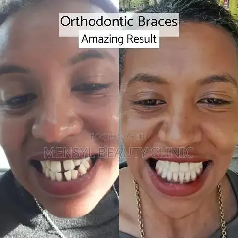 Professional Dental Braces Correction of Alignment Orthodontic · Photo 2