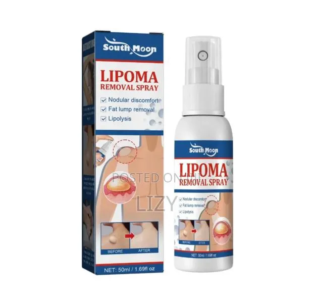 Lipoma Removal Spray · Photo 1