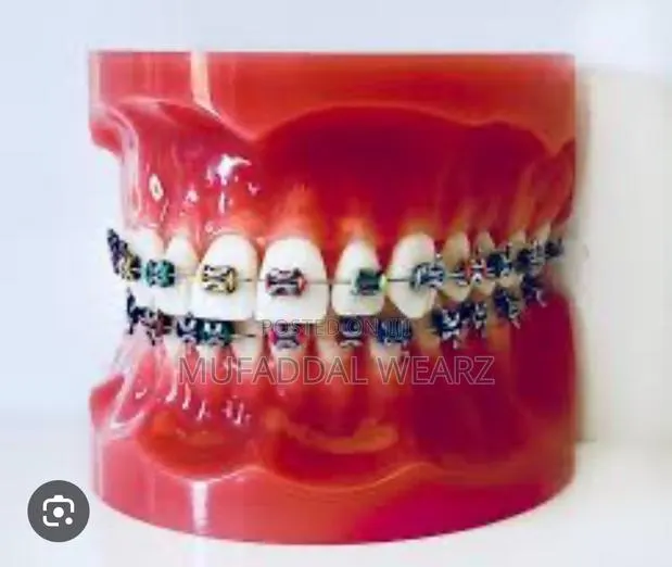 Perfect Your Smile With Braces and Aligners