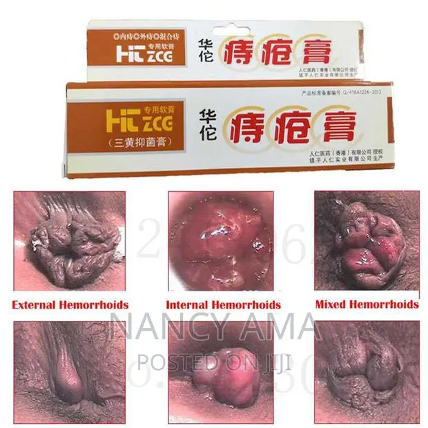 Piles Cream (Kooko) · Photo 1