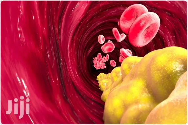 Natural Solution For High Blood Pressure · Photo 1