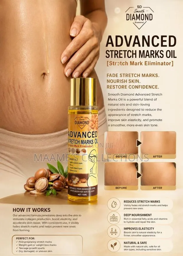 Smooth Diamond Advanced Stretch Marks Oil ( Stretch Marks Eliminator) · Photo 1