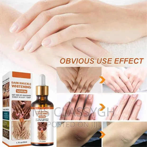 Dark Knuckles Fast Whitening Serum Hand Knuckle Elbows Knee · Photo 1