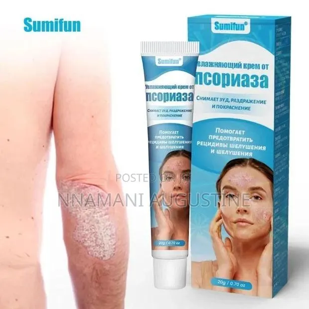 Psoriasis Cream Dermatitis Ointment · Photo 1