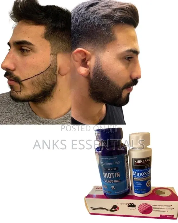Kirkland Foam + Biotin + Roller – Hair Restoration Combo · Photo 1
