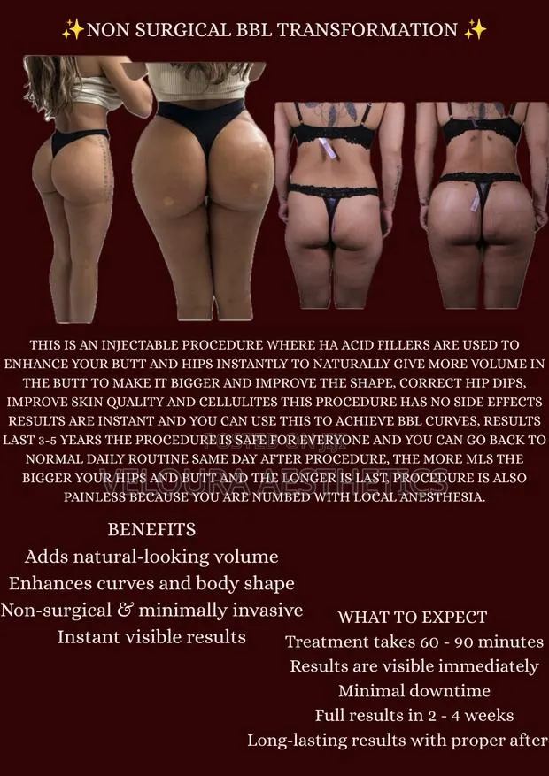 Non-Surgical BBL Fillers | Hip Dip Enhancement | Accra · Photo 1