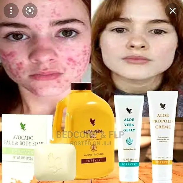 Forever Acne and Skin Restorer Pack · Photo 1