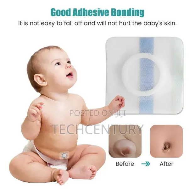 Baby Umbilical Hernia Patch · Photo 3