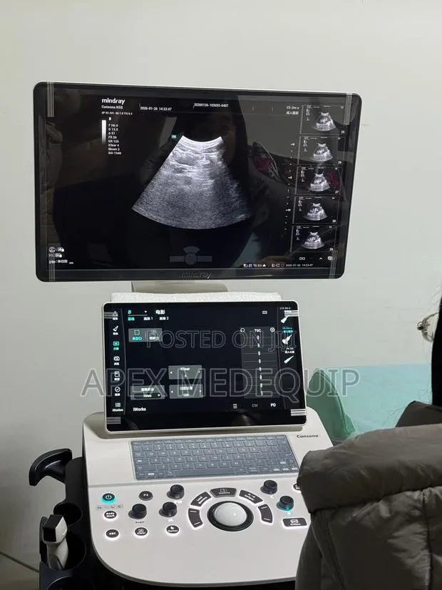 Mindray Consona N5s Color Doppler Ultrasound System + 3 Probes · Photo 1