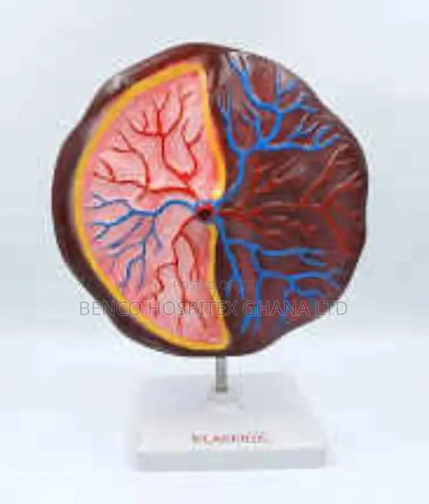 Placenta Model · Photo 1