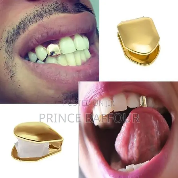 Hip Hop Teeth / Simple Gold Grillz · Photo 1