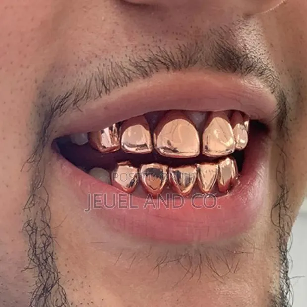Original Rose Gold Grillz / Slugs · Photo 1