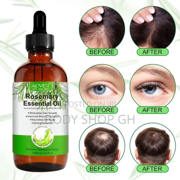 Rosemary Oil for Hair Growth,Hair Thinning ,Beard and Edges · Photo 1