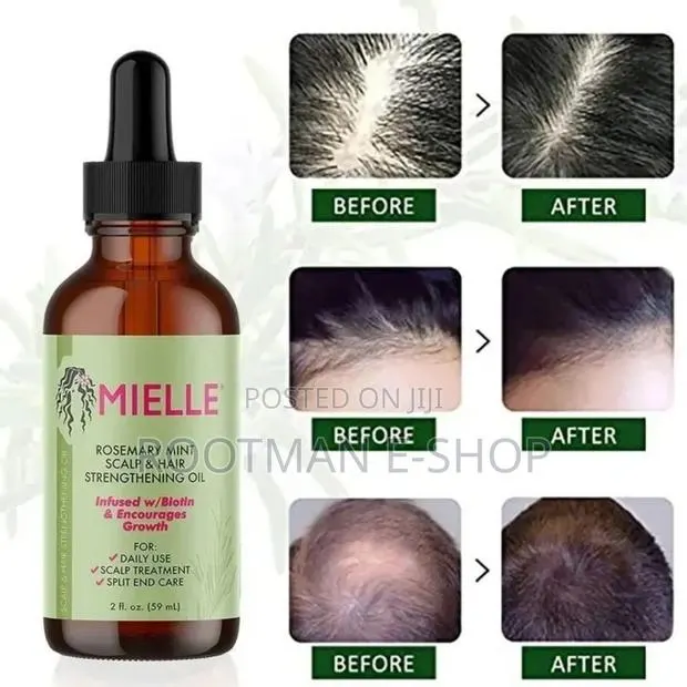 Mielle Organics Rosemary Mint Scalp Hair Strengthenin Oil · Photo 1