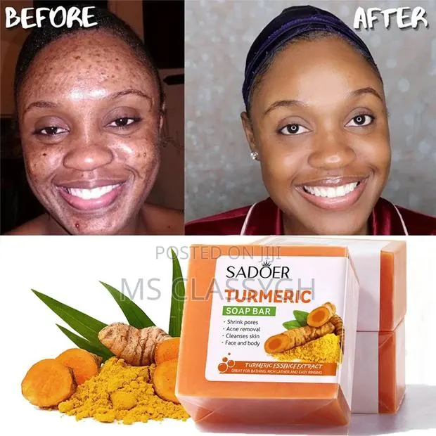 100g Turmeric Ginger Soap Anti Acne Skin Brighten Face Clean · Photo 1