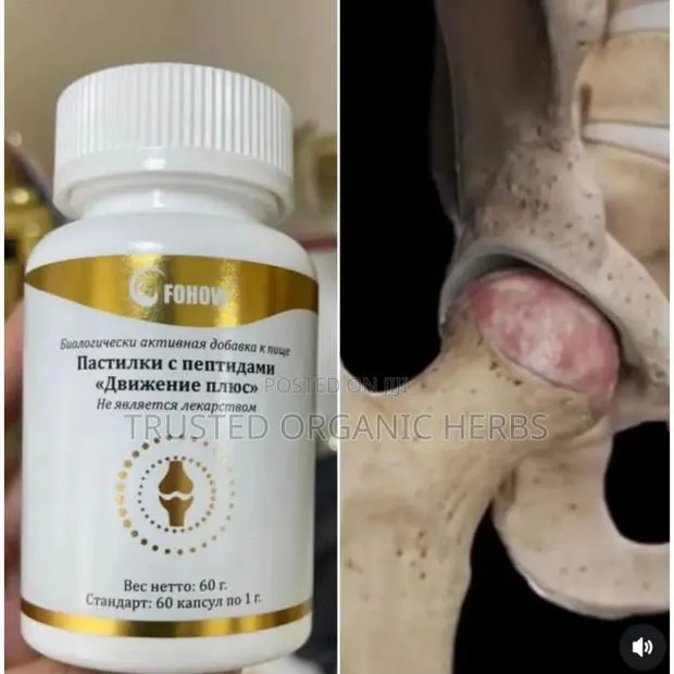 Natural Solution for Joint Pains, Osteoarthritis Rheumatoid Arthritis · Photo 1