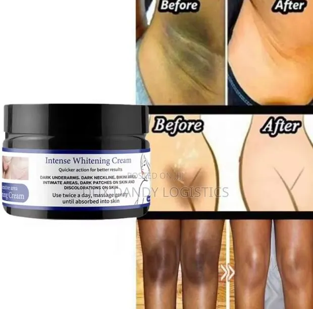 Intense Whitening Cream · Photo 1