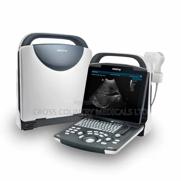 Mindray DP10 Ultrasound Scan Machine · Photo 1
