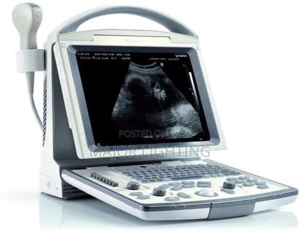 Ultra Sound Scanning Machine · Photo 1