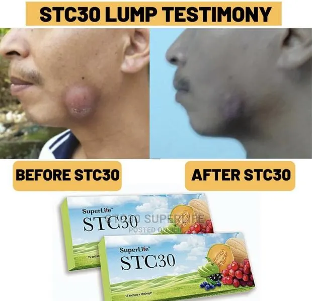 STC30 Medicinal Supplements · Photo 1