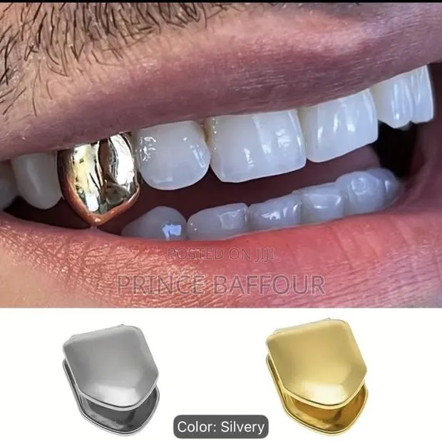 Hip Hop Teeth / Simple Gold Grillz · Photo 4