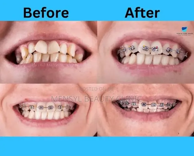 Professional Dental Braces Correction of Alignment Orthodontic · Photo 1