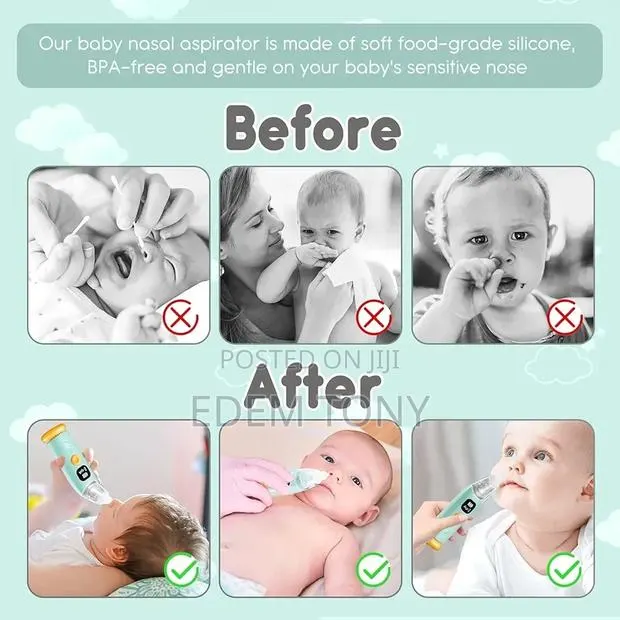 Baby Nasal Aspirator- With 3 Suction Levels, Music Rechargeable · Photo 4
