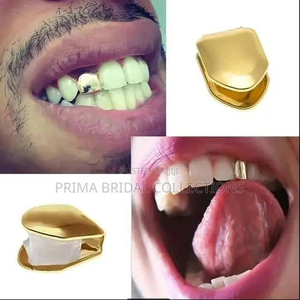 Grillz Teeth · Photo 1