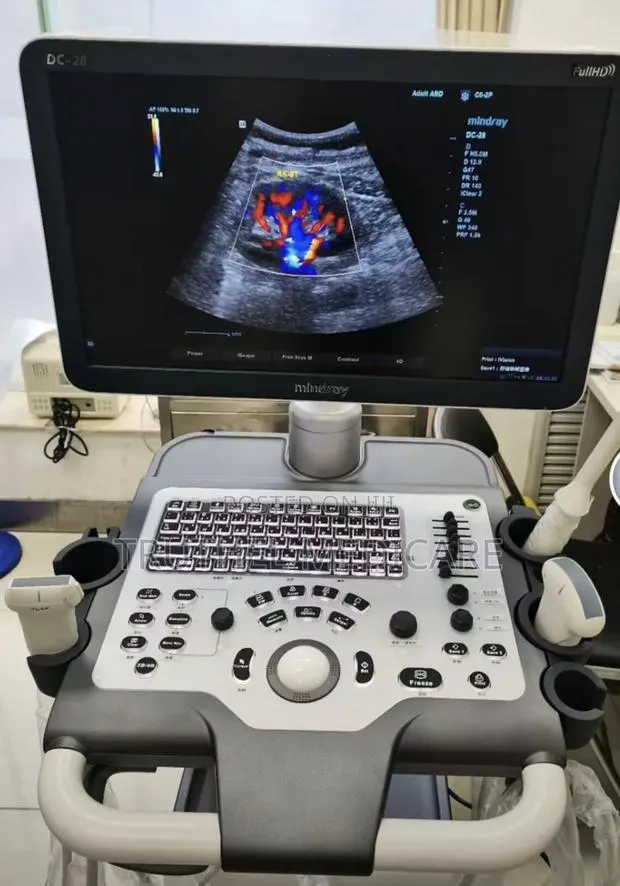 Mindray Ultrasound Machine - Dc 32 Full Hd · Photo 1