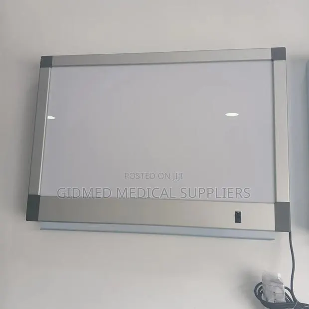X Ray Viewer Big · Photo 1