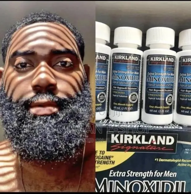 Original Kirkland Minoxidil (For Beared and Hairloss) · Photo 1
