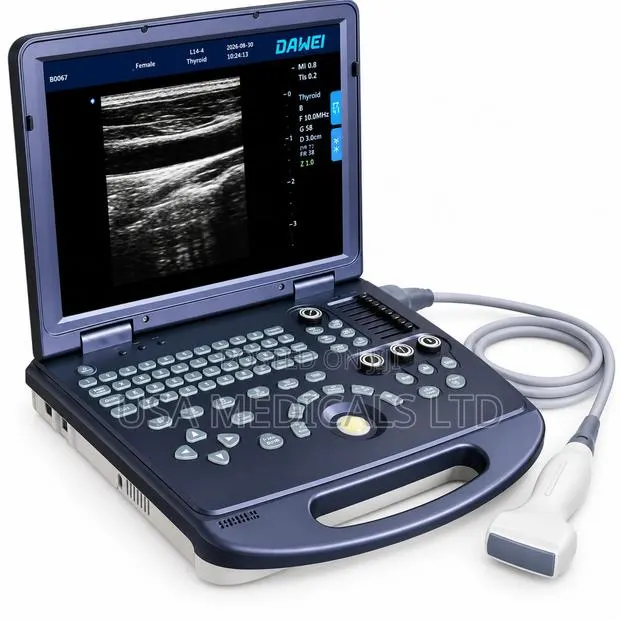 Ultrasound Scan Trolley With Probe(DAWEI) · Photo 1