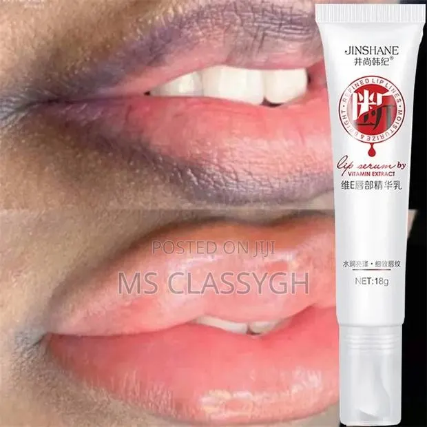 Black Lip Removal Pigmentation Fade Dull Pink Lip Balm Brigh · Photo 1