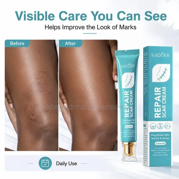 Scar Removal Cream · Photo 1