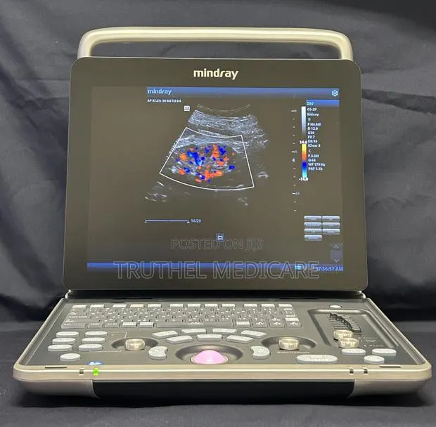 Mindray Portable Ultrasound Machine - Z60 Pro · Photo 1