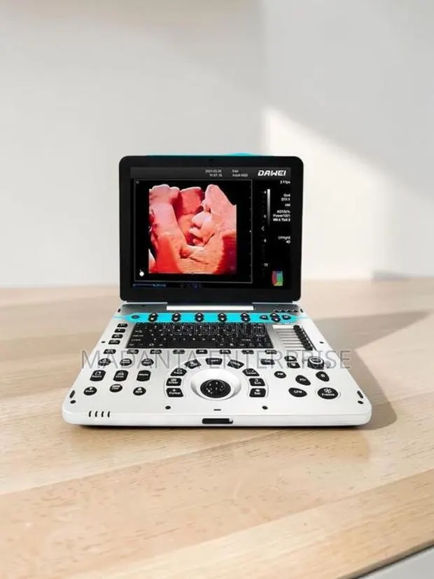 Ultrasound Scan Color Doppler "Dawei" · Photo 1