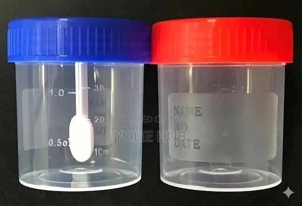 Urine Containers (30mls ,60mls 100mls) · Photo 1