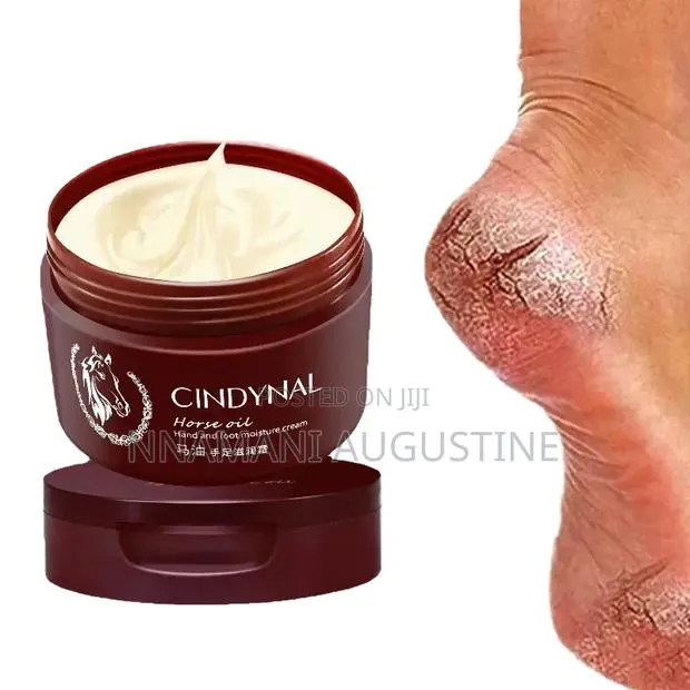 Foot Peel Remover Cream · Photo 1