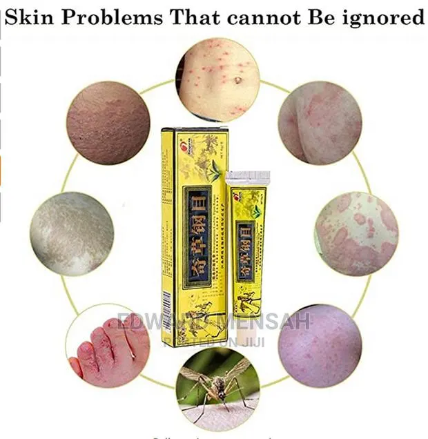 Eczema, Psoriasis · Photo 1