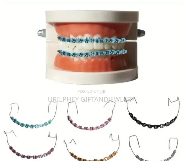 Fashionable Braces · Photo 1