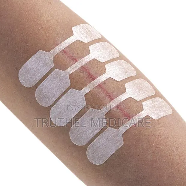 Steri Strips - Skin Closure · Photo 1