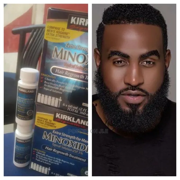 Originalkirkland Minoxidil · Photo 1