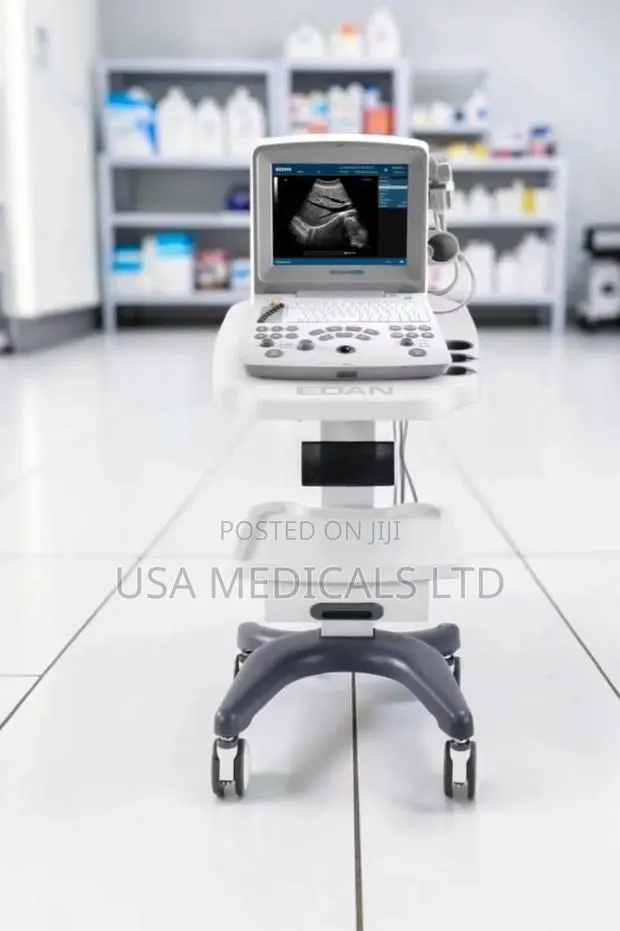 Ultrasound Scan Machine(Edan 60) With Two Probes and Trolley · Photo 1