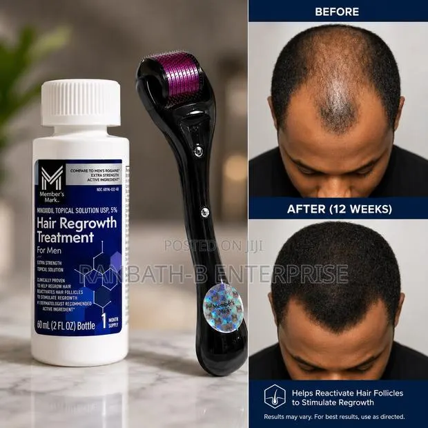 Member’s Mark Minoxidil 5% Hair Regrowth Treatment + Derma Roller · Photo 1