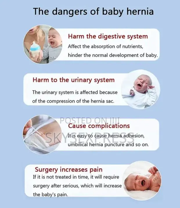 Baby Umbilical Hernia Belt · Photo 4