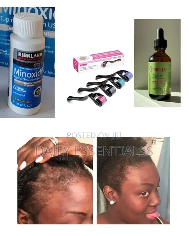 Beard Hair Growth System That Works · Photo 1