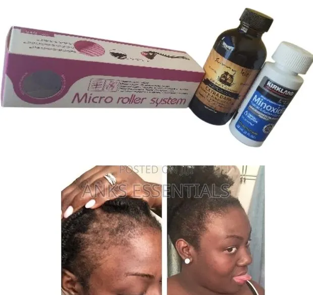 Kirkland Oil, Castor Oil Roller Combo · Photo 1
