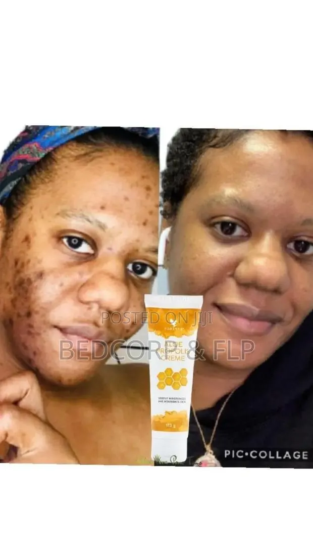 Forever Propolis Creme for Discoloration · Photo 1