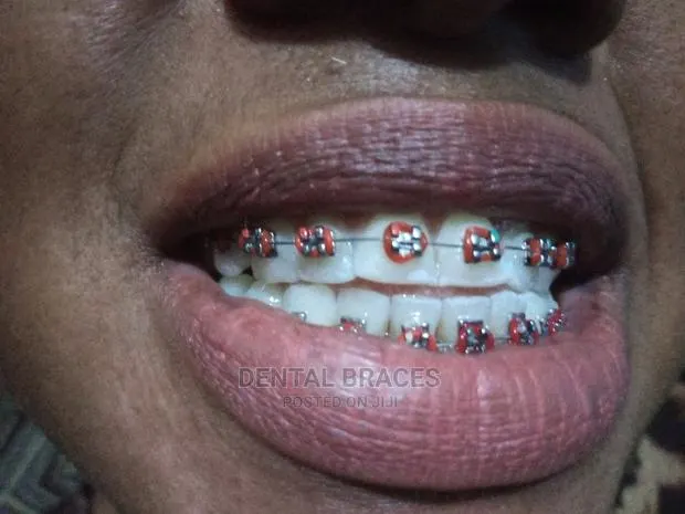 Get Fashion Brace Smile Good · Photo 1